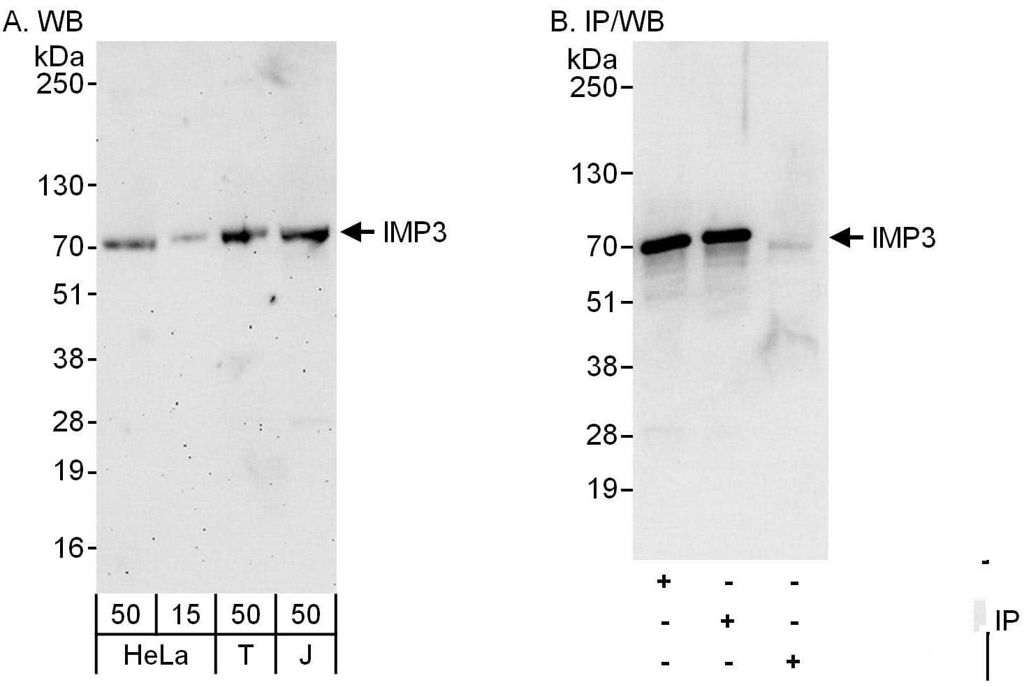 IGF2BP3 Antibody