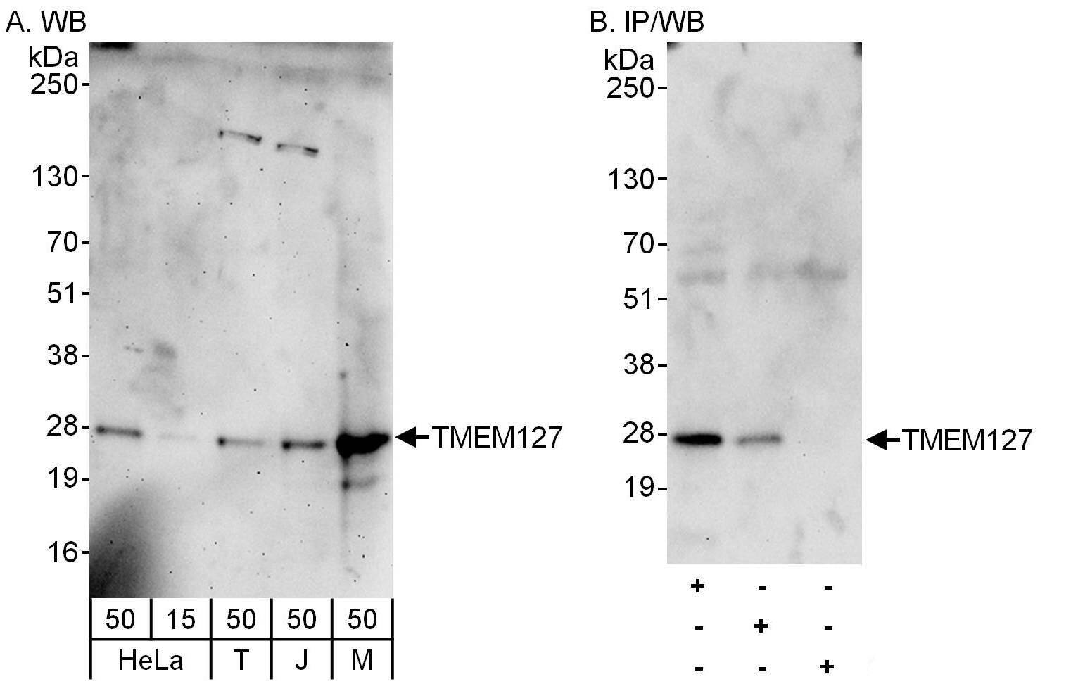TMEM127 Antibody