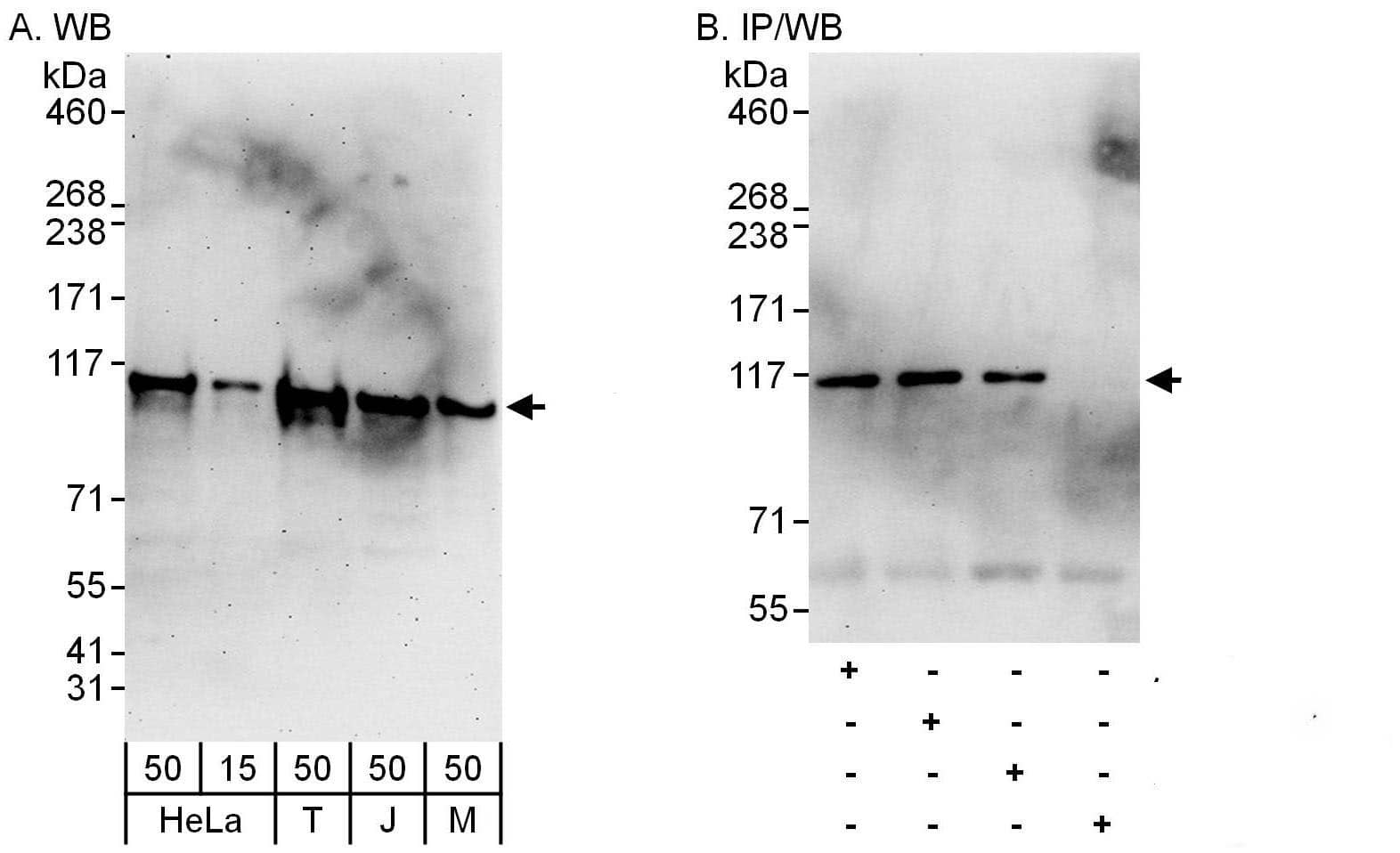 Alanyl tRNA synthetase Antibody