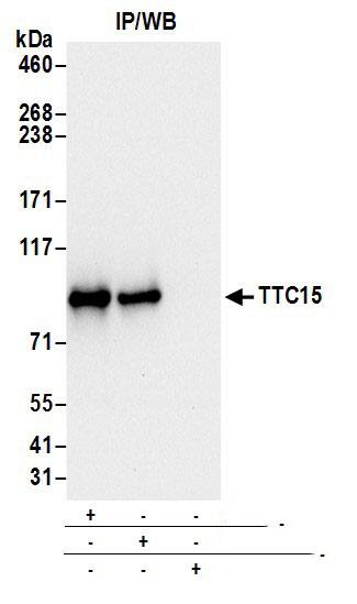 TTC15 Antibody
