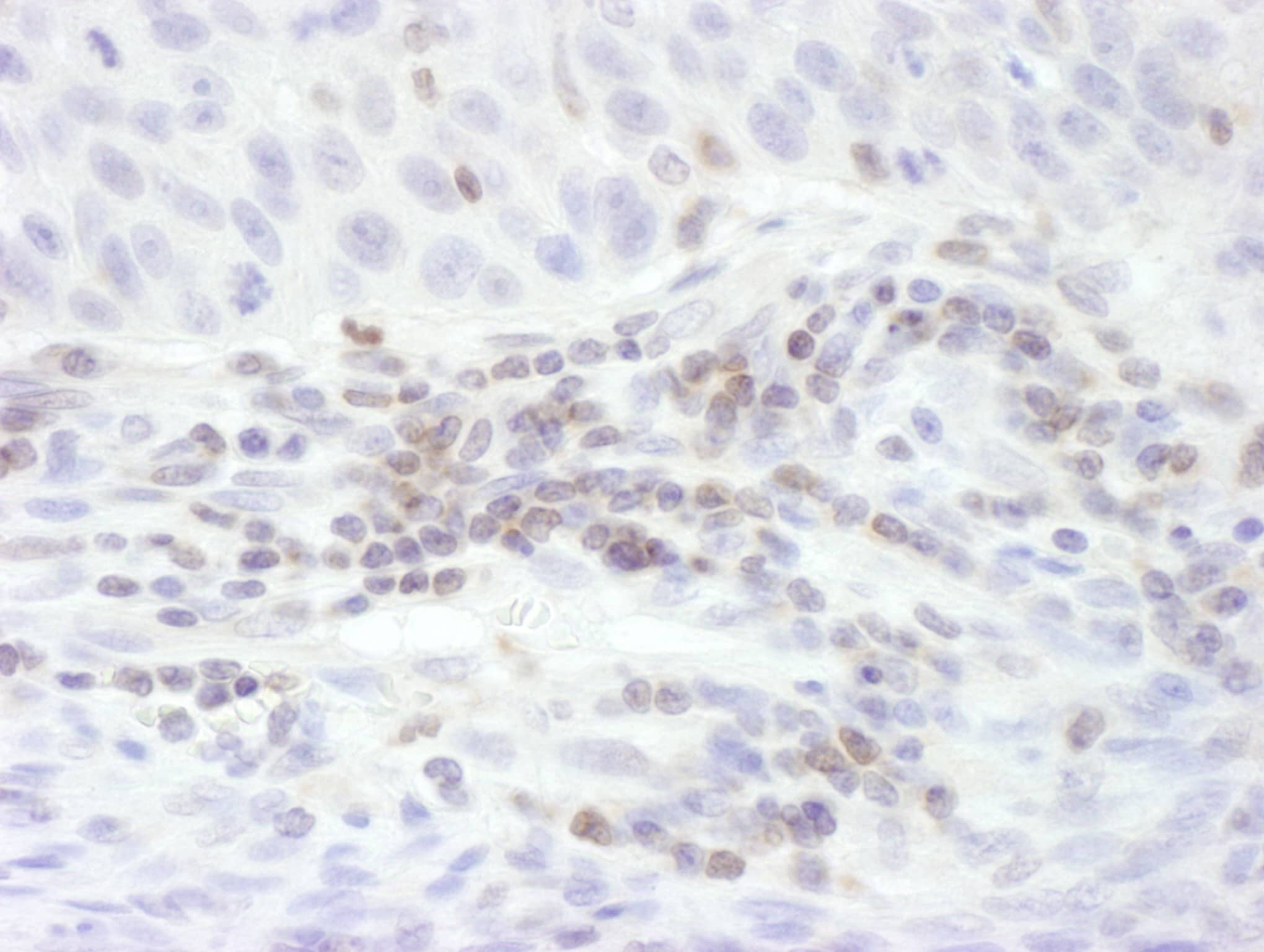 STAT5b Antibody