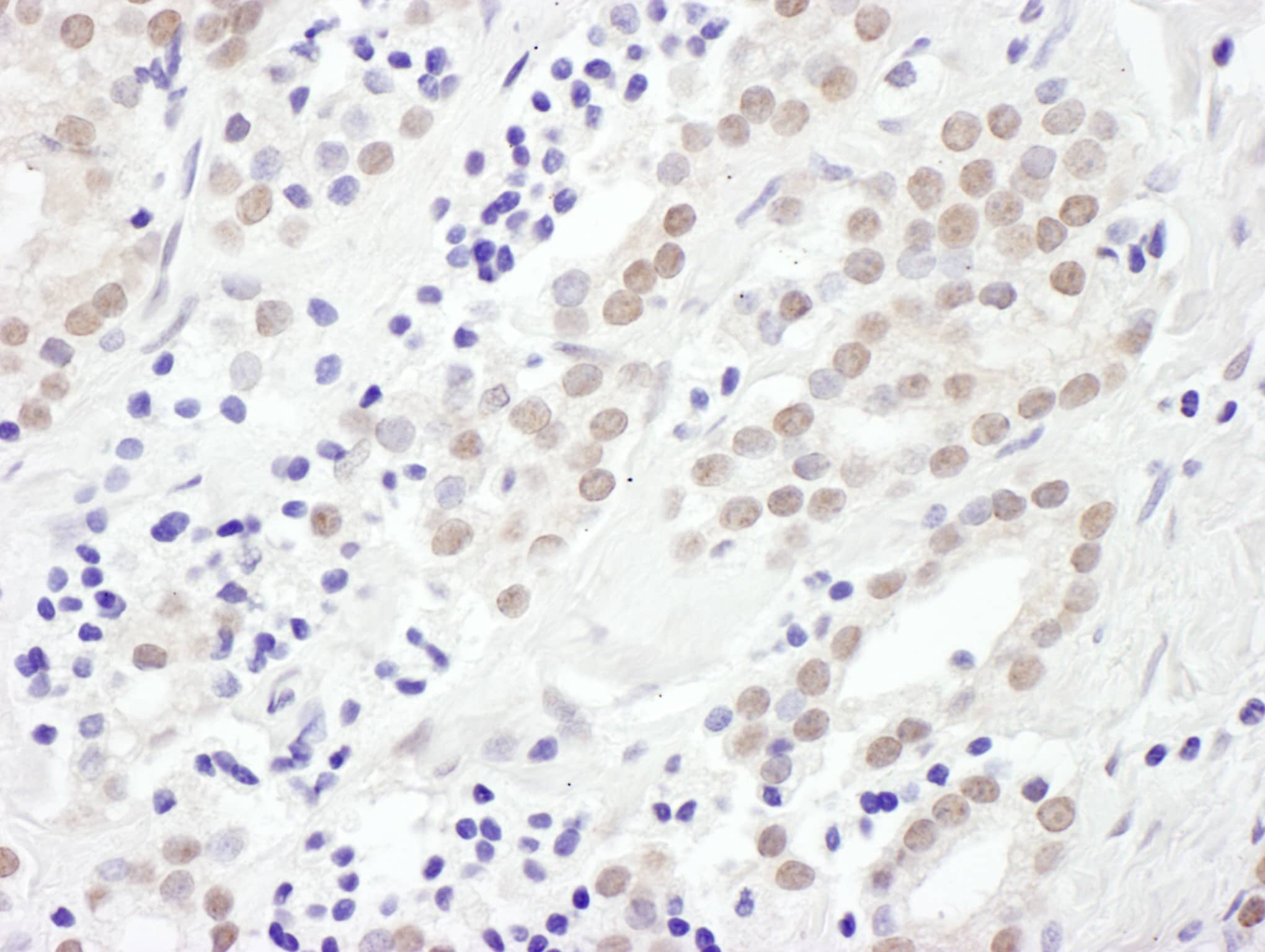 Exosome component 10 Antibody