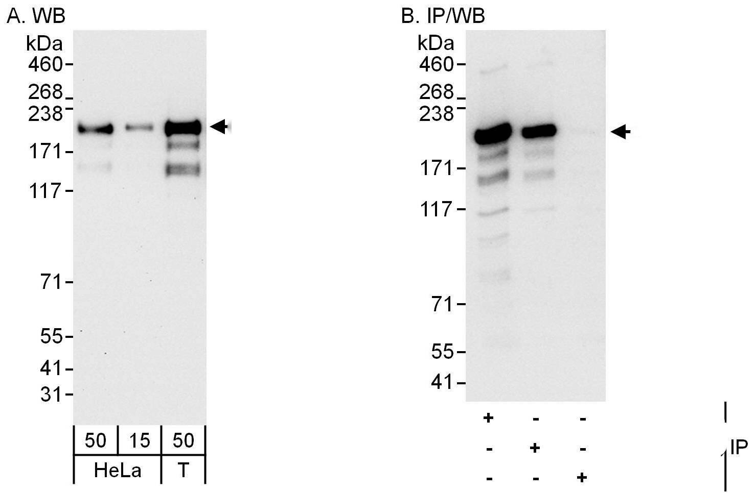 CLIP170 Antibody