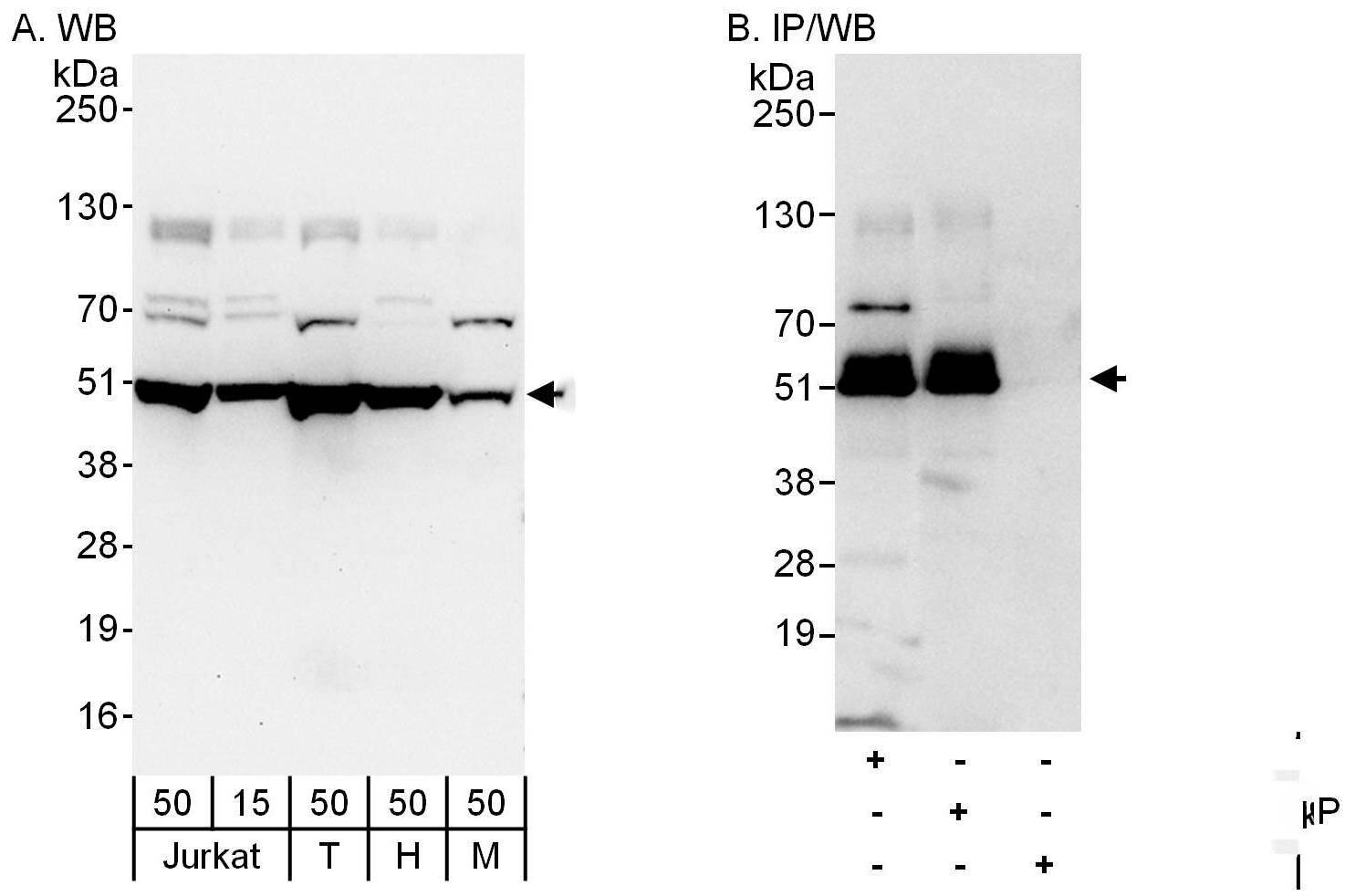 Dynactin Subunit 2/DCTN2/DCTN-50 Antibody