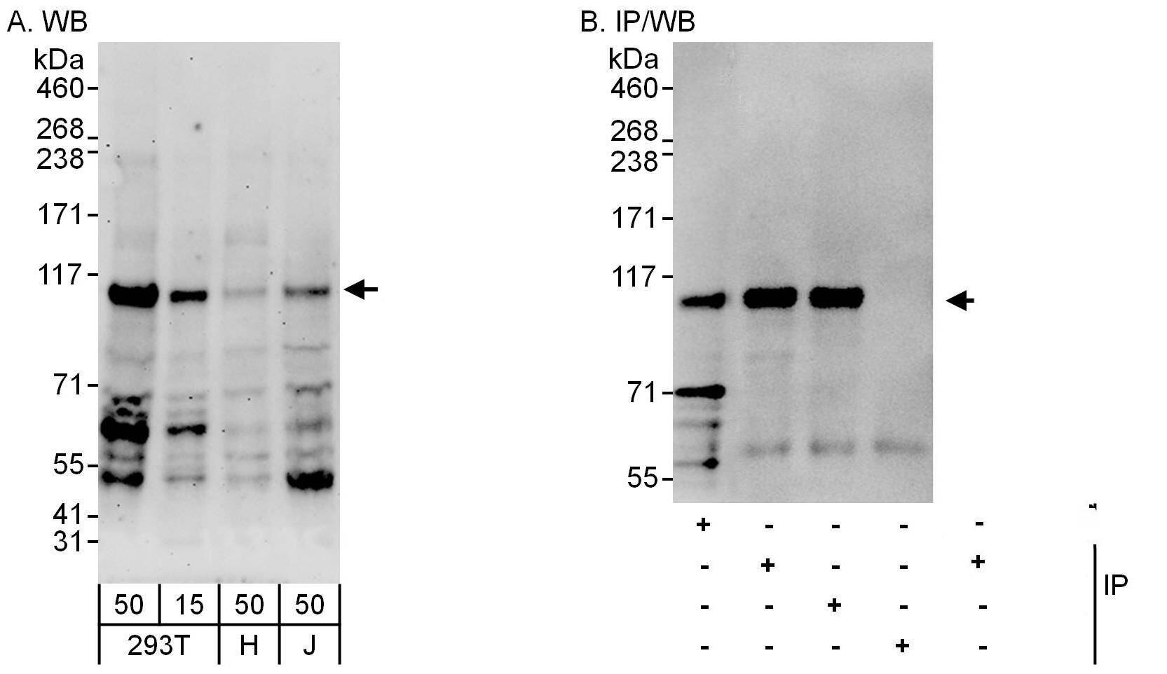 beta Adducin Antibody