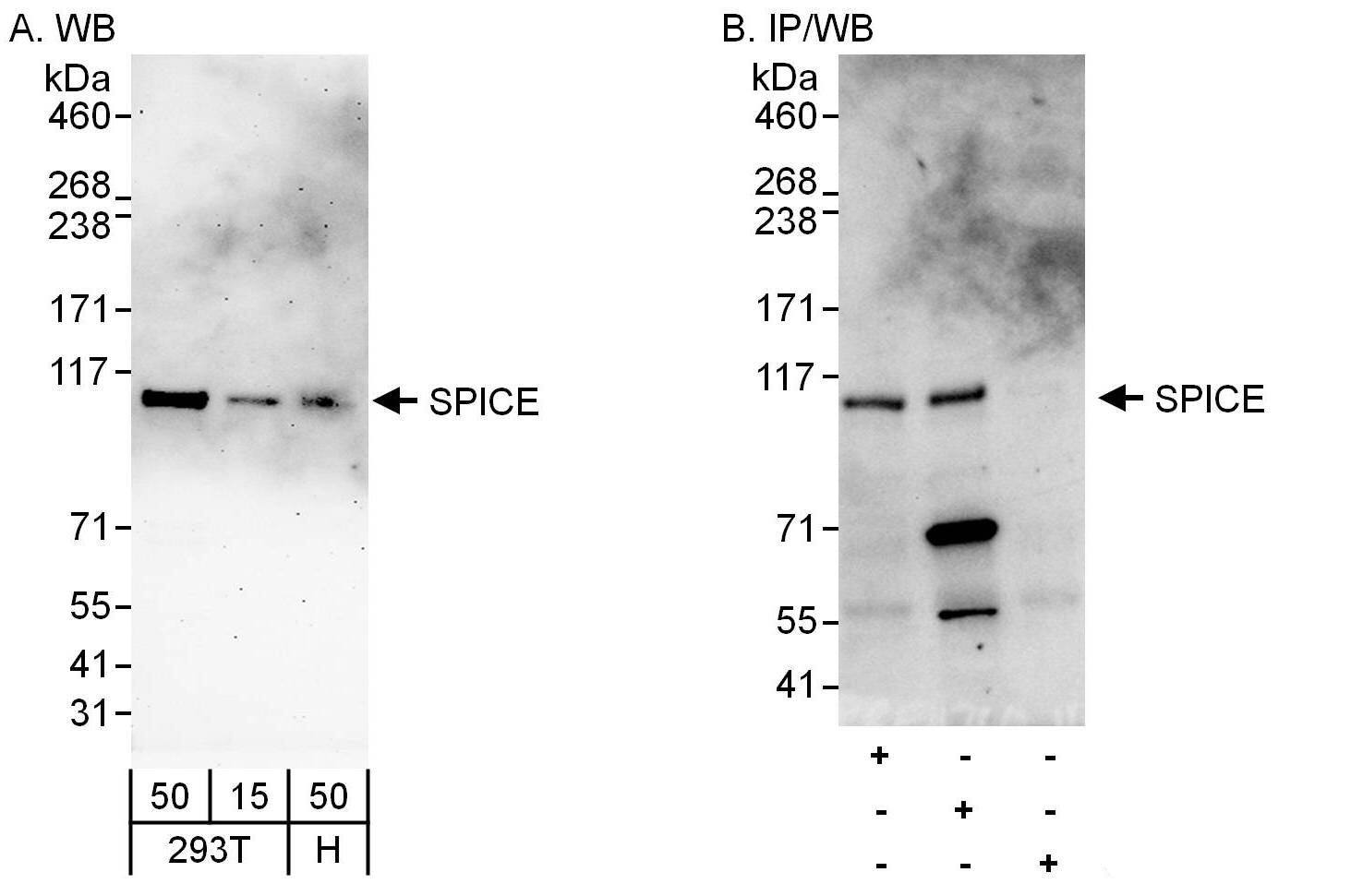 SPICE1 Antibody