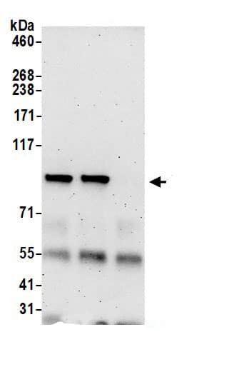 HECTD3 Antibody