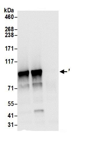 ELAC2 Antibody
