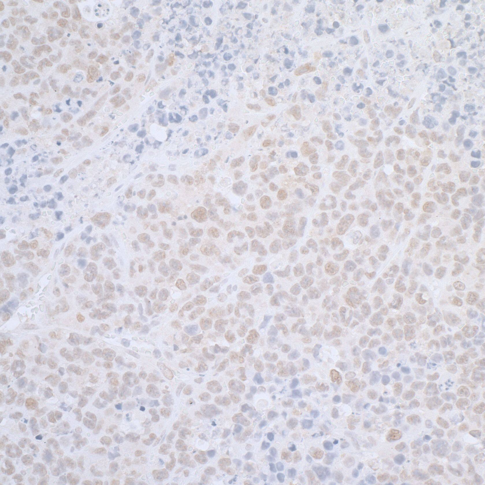 ELAC2 Antibody