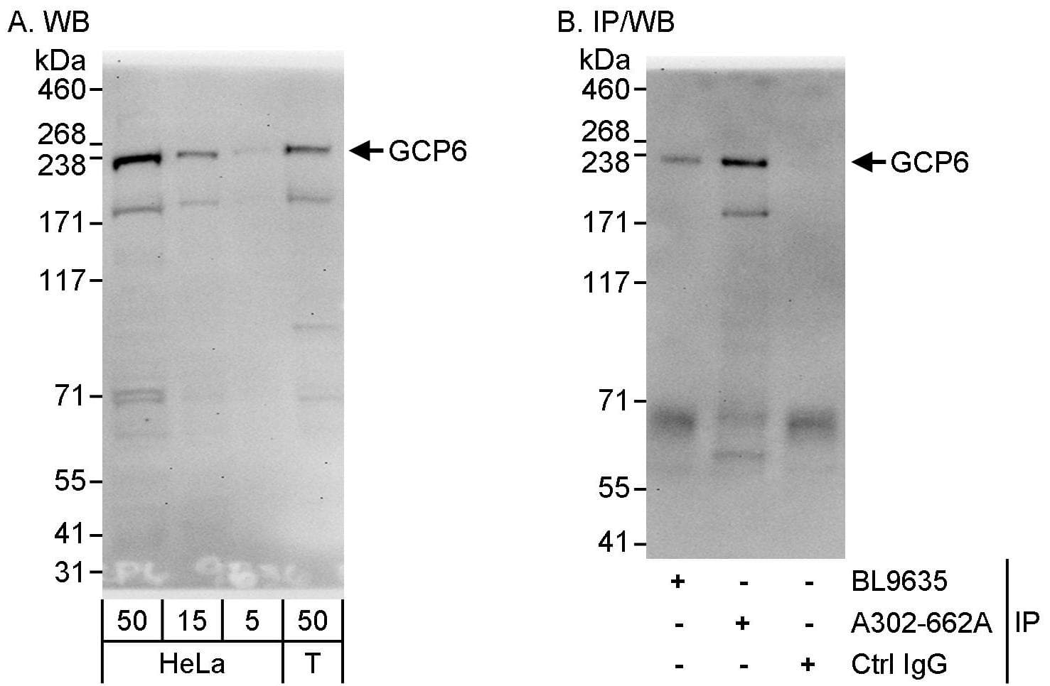 TUBGCP6 Antibody