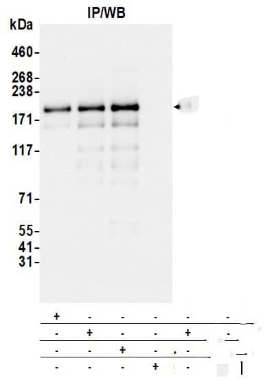 Blooms Syndrome Protein Blm Antibody