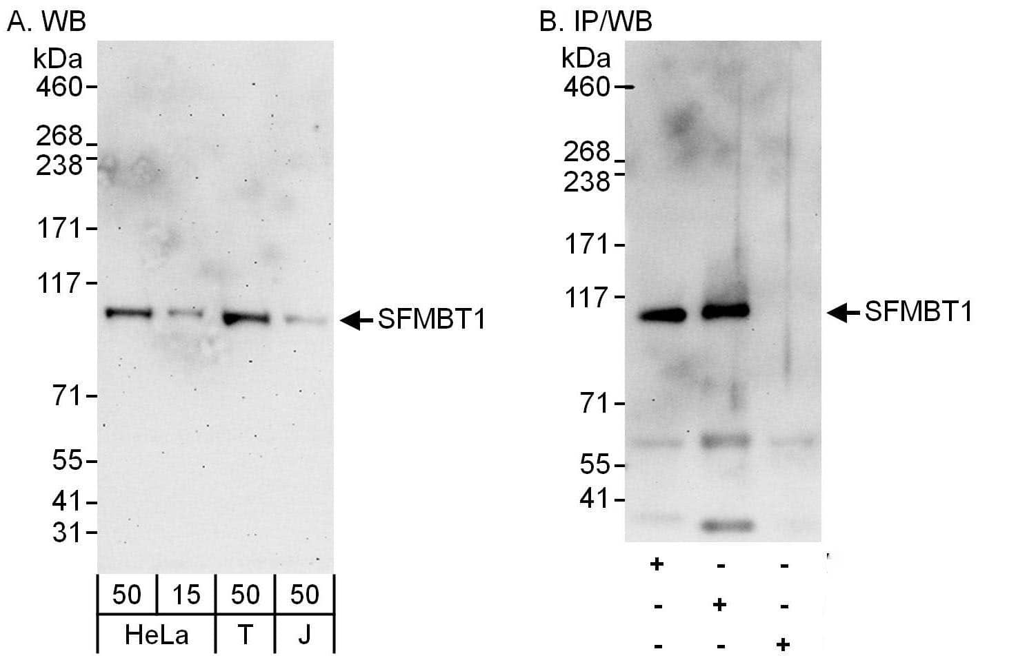 SFMBT1 Antibody