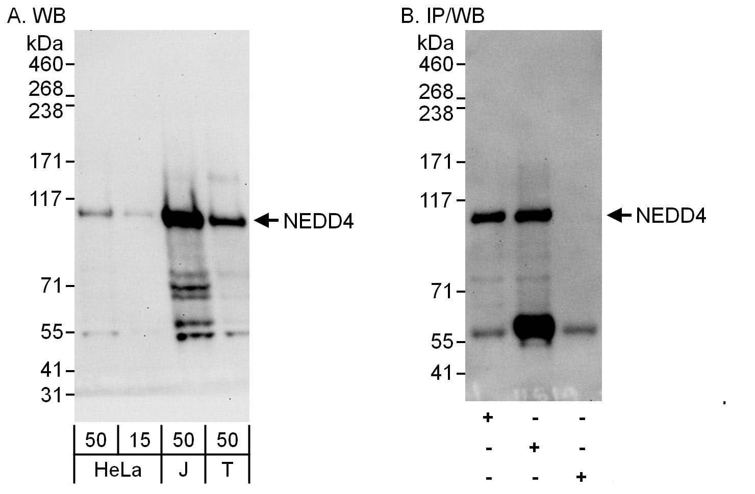 NEDD4 Antibody