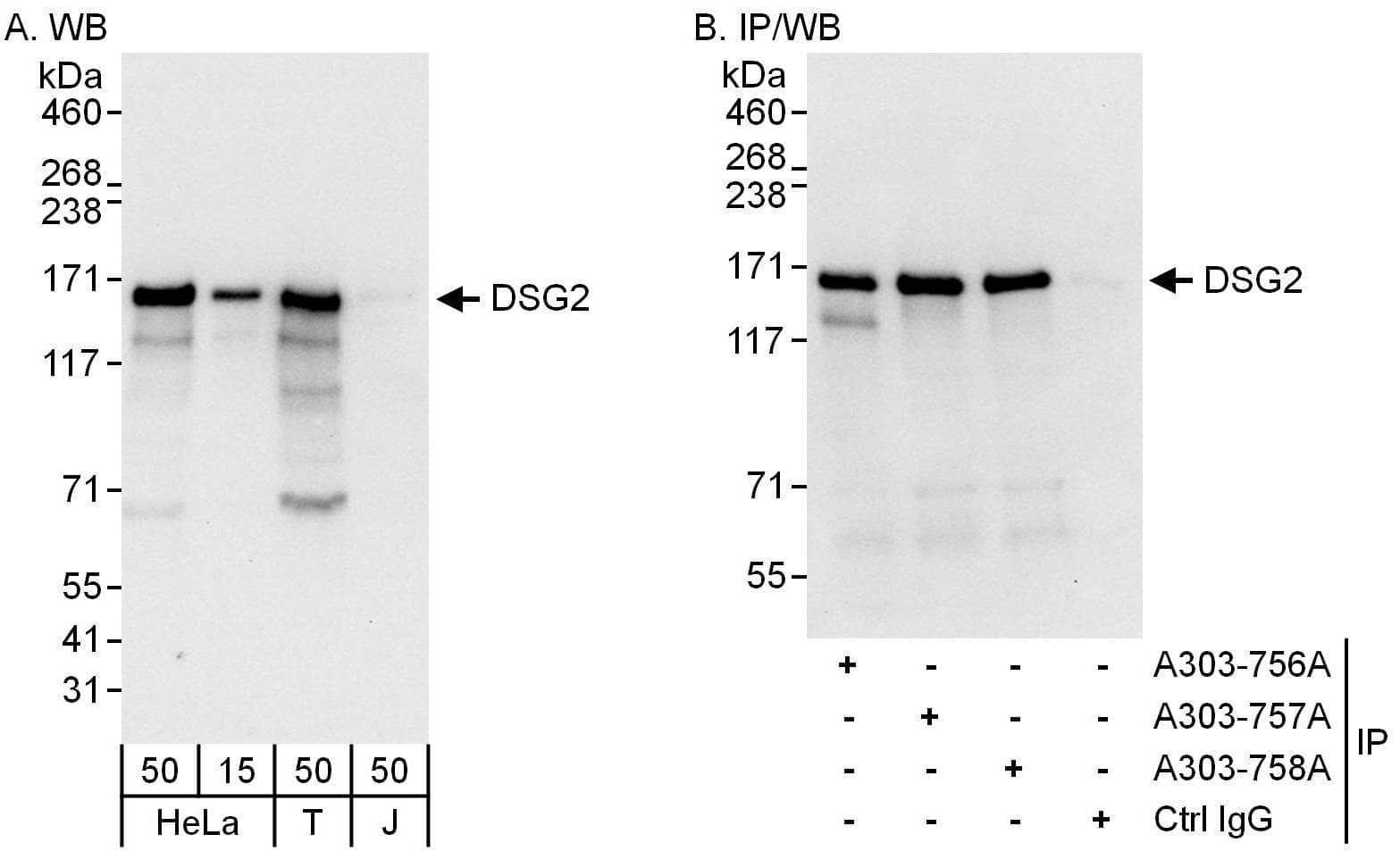 Desmoglein-2 Antibody