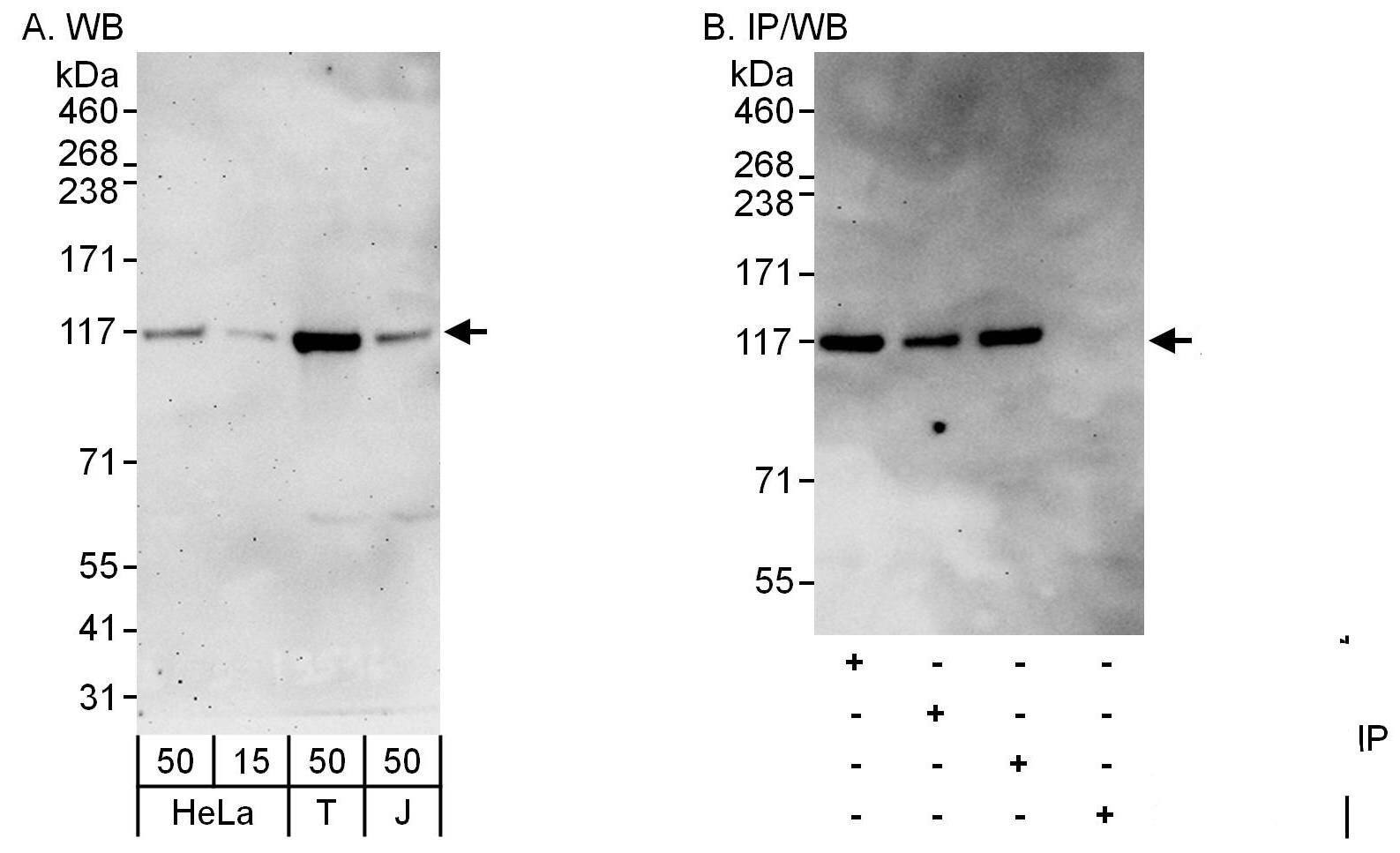 DIS3 Antibody