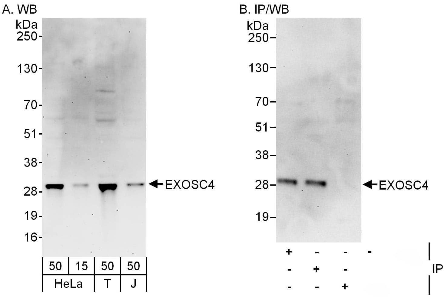 Exosome component 4 Antibody