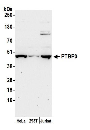 ROD1 Antibody