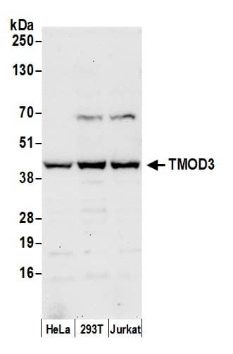 Tropomodulin 3 Antibody