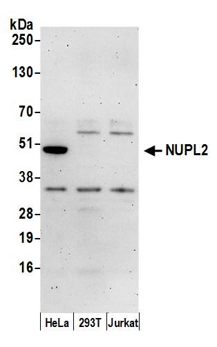 NUPL2 Antibody