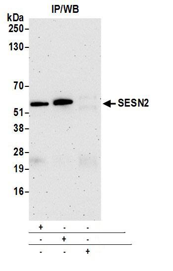 SESN2 Antibody