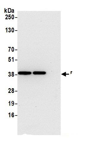 RPRD1B Antibody