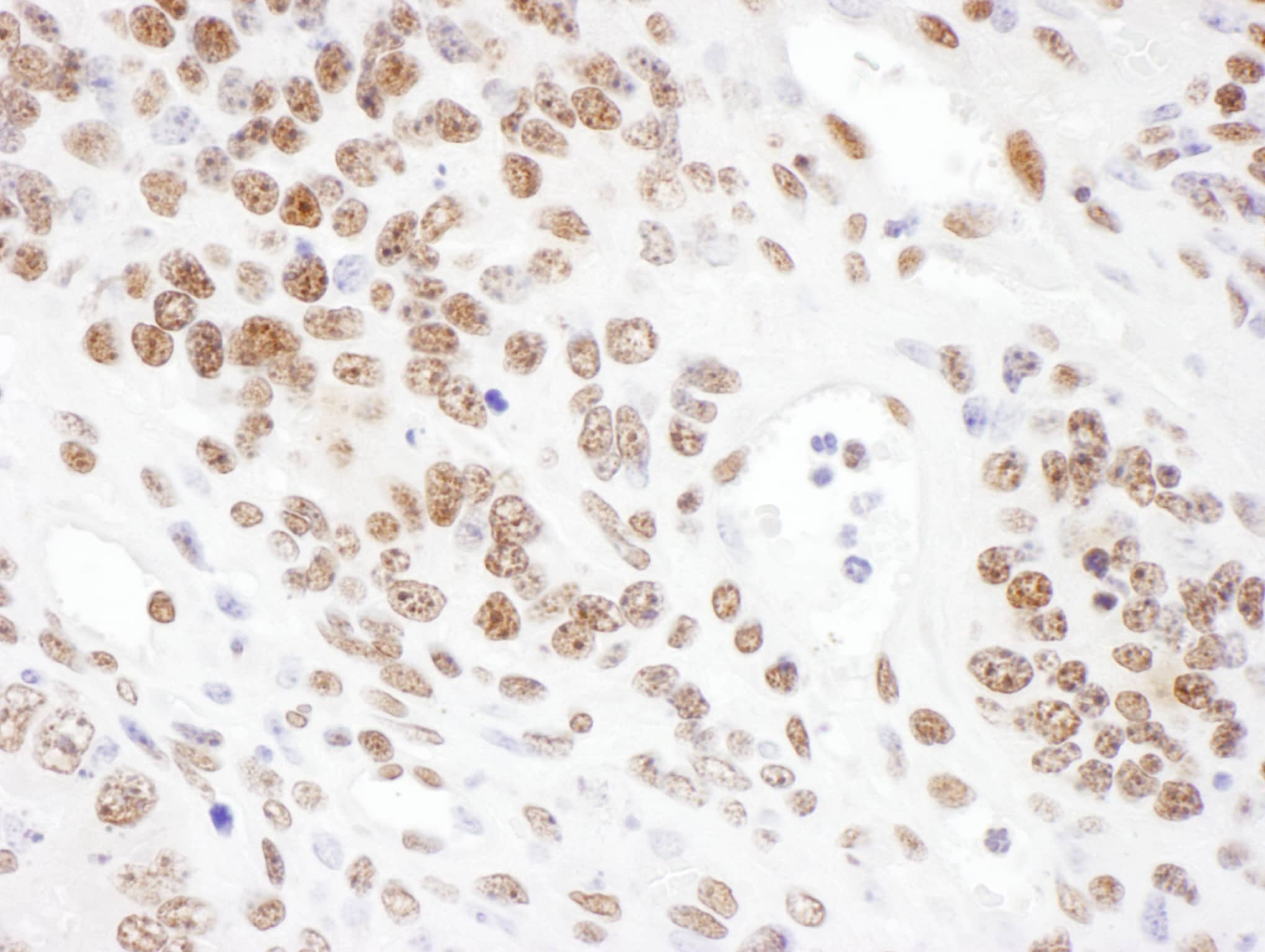 ARS2 Antibody