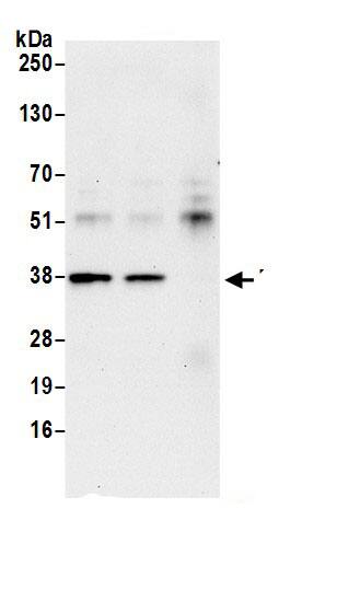 FDPS Antibody