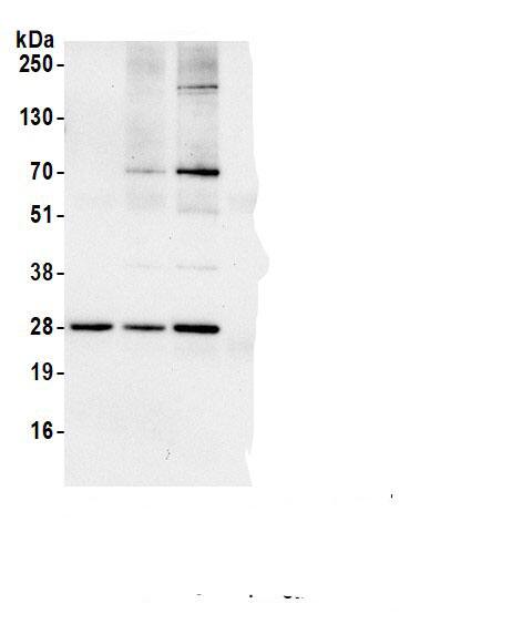 RPL10A Antibody