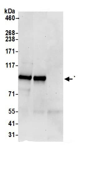 YTHDC1 Antibody