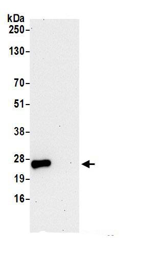 gamma-Glutamylcyclotransferase/CRF21/GGCT Antibody