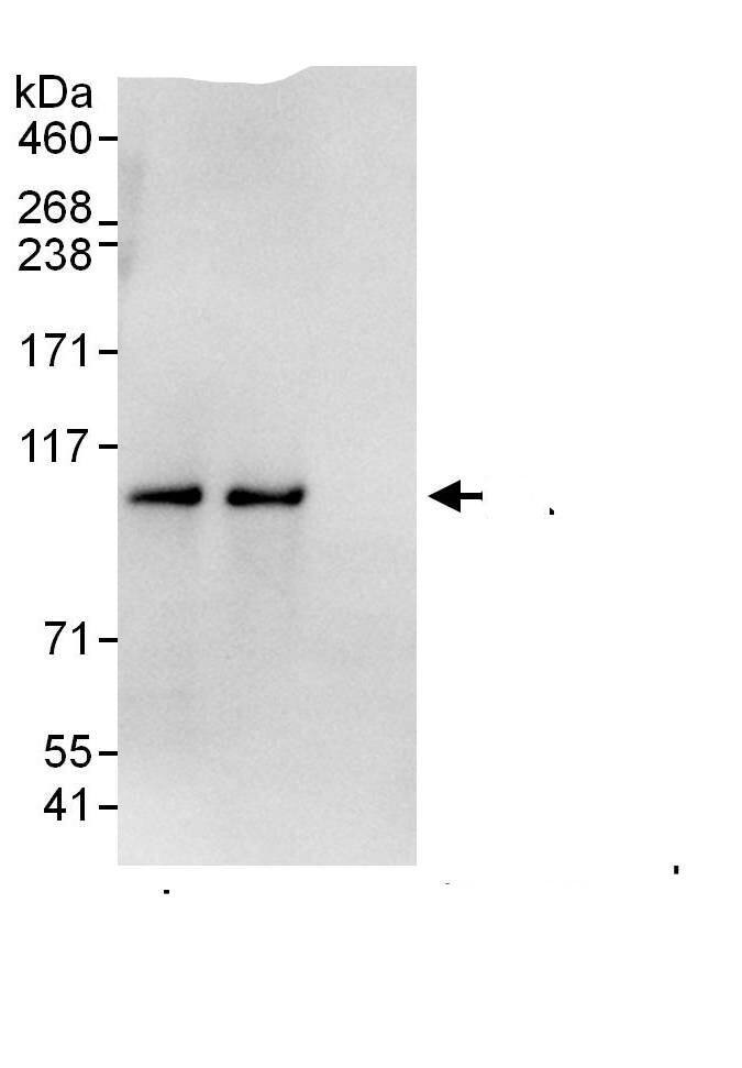 Proteasome 19S 10B Antibody