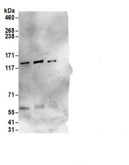 DNA Polymerase delta, catalytic subunit Antibody