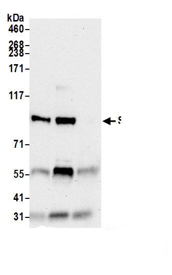 SARDH Antibody