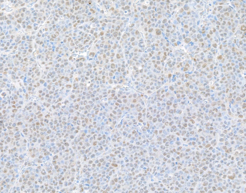 Rpn2 Antibody