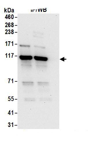 ADAR Antibody