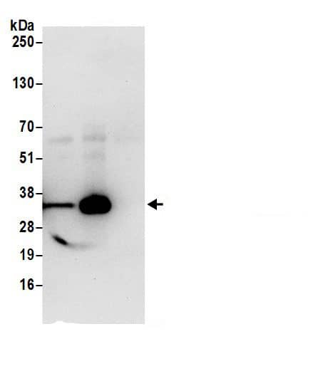 Lactate Dehydrogenase Antibody