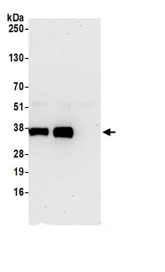 PPA2 Antibody