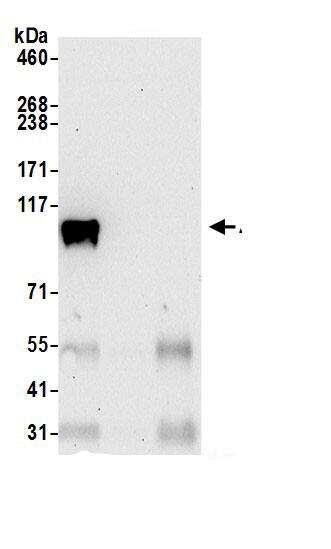 Aspartate beta hydroxylase Antibody