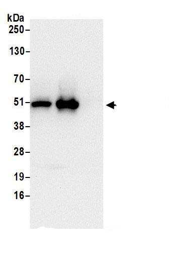 THUMPD1 Antibody