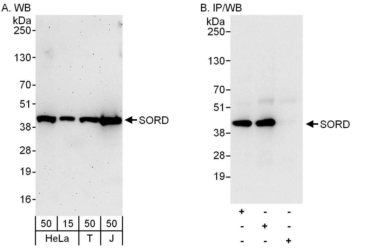 Sorbitol Dehydrogenase Antibody