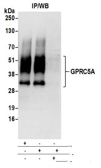 GPRC5A/RAI3 Antibody