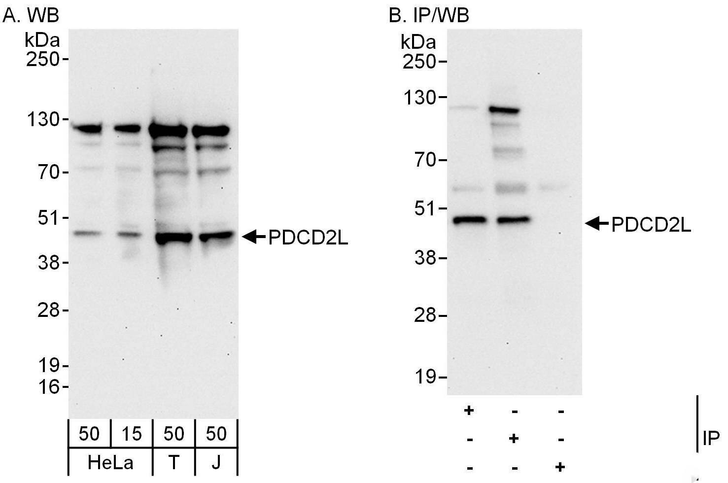 PDCD2L Antibody