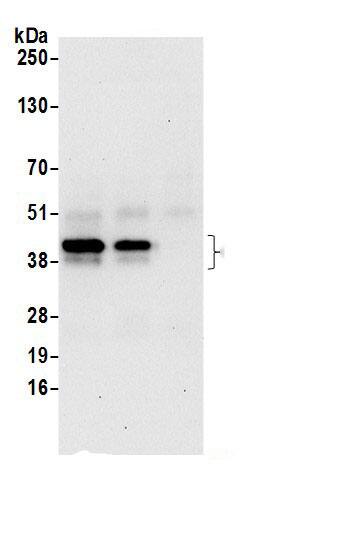 SNURPORTIN1 Antibody