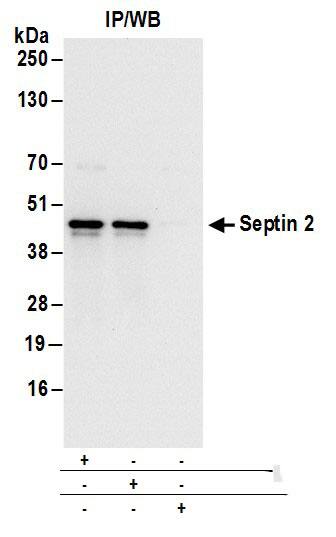 Septin-2 Antibody
