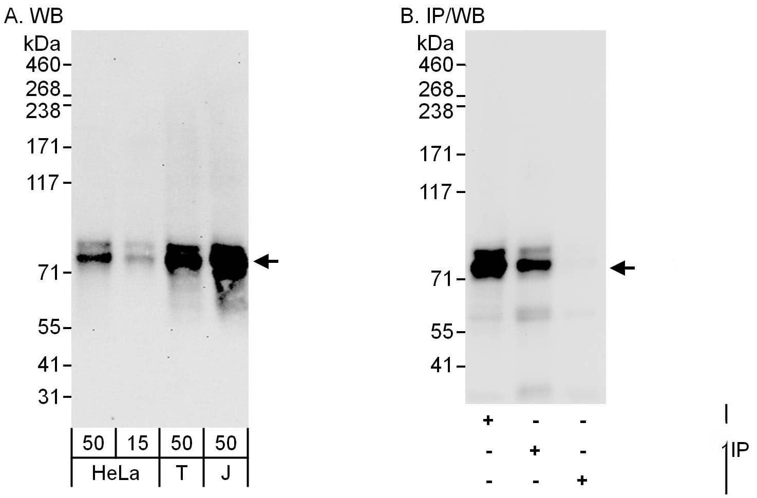 ZNF384 Antibody