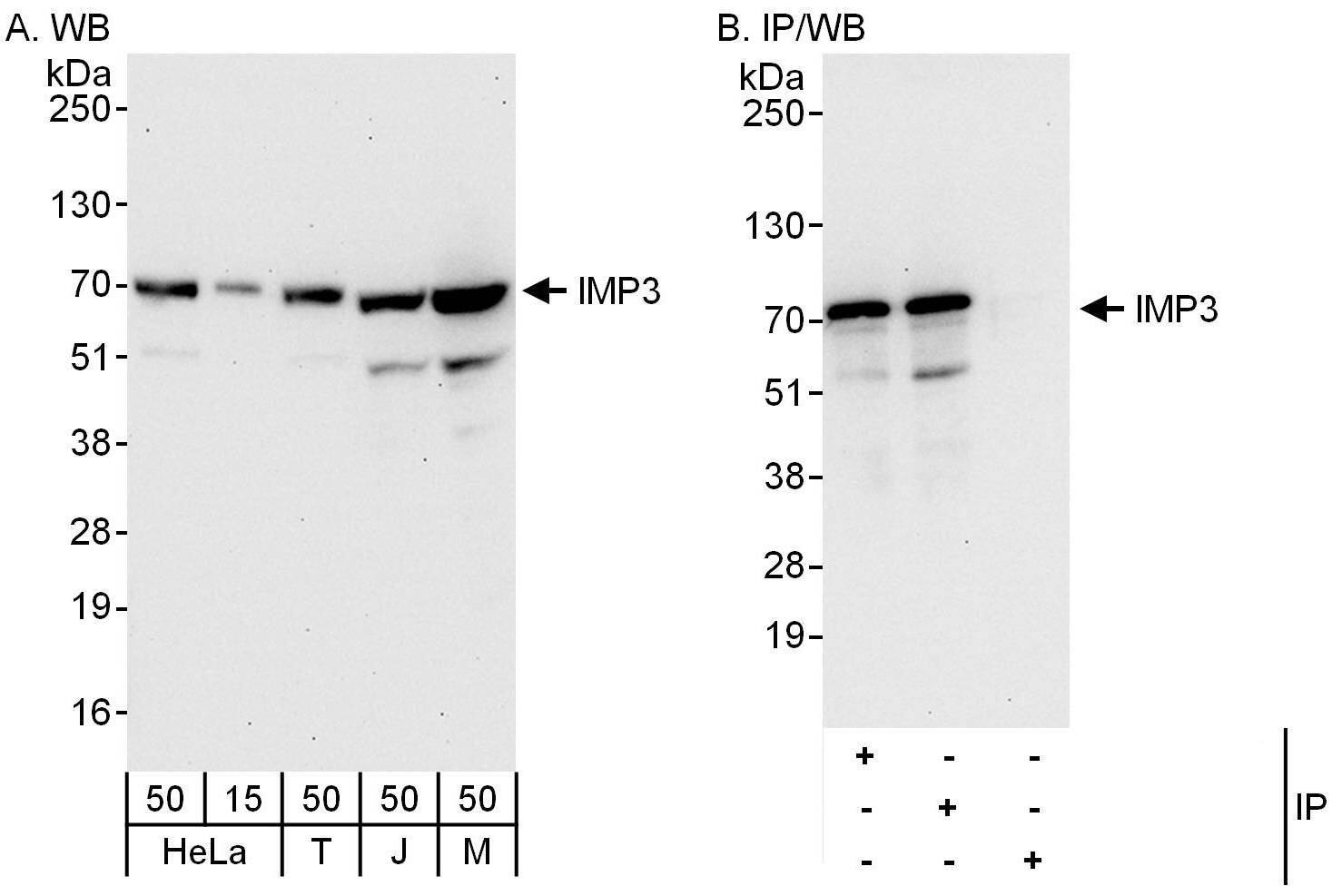 IGF2BP3 Antibody