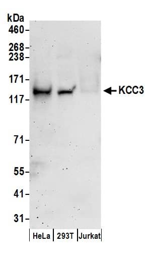 KCC3/SLC12A6 Antibody