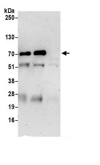 PRKCSH Antibody