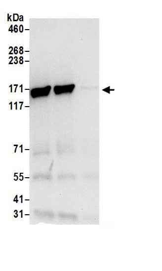 Isoleucyl tRNA synthetase Antibody