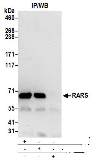 Arginyl tRNA synthetase Antibody